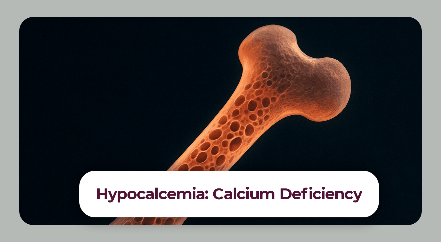 Calcium: Is there a deficiency?