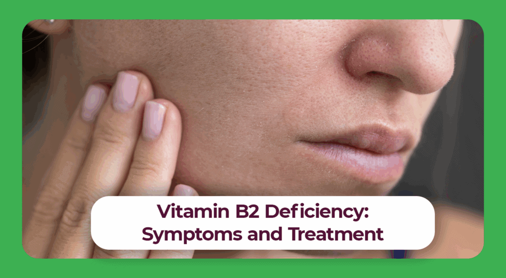 Vitamin B2 Deficiency: Symptoms & Treatment